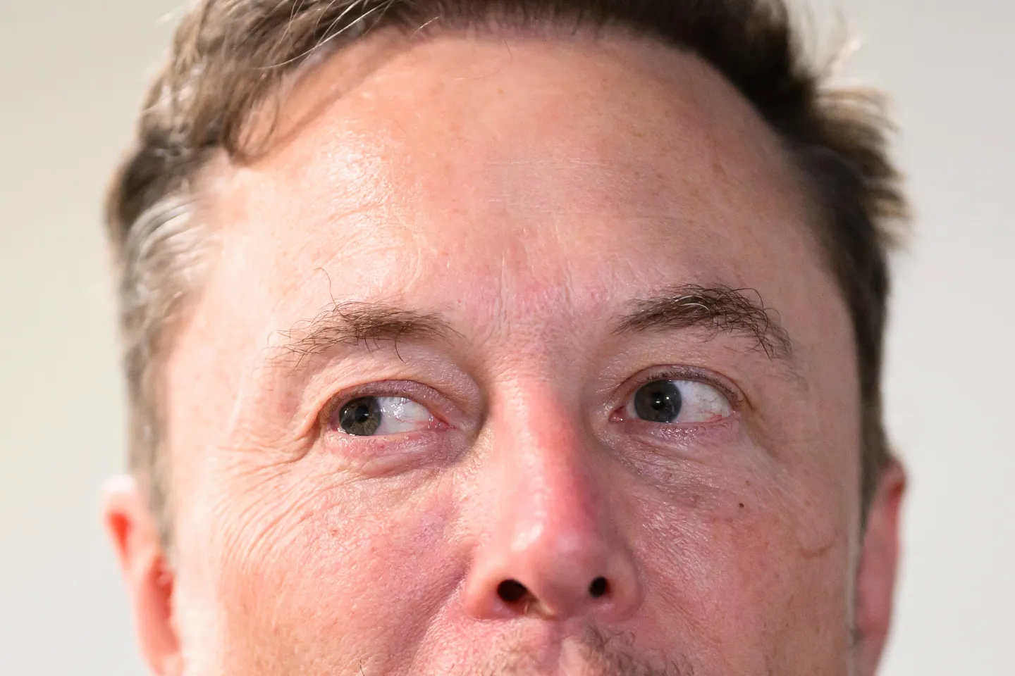 The top of Elon Musk's head